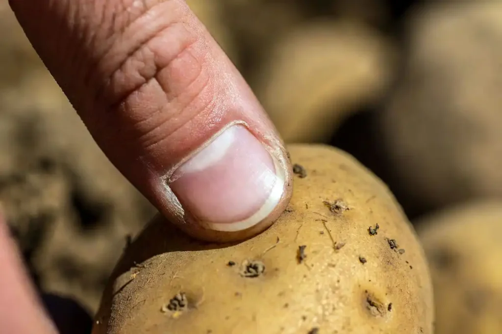 thumb pressing against potato skin to check if it is ready to harvest